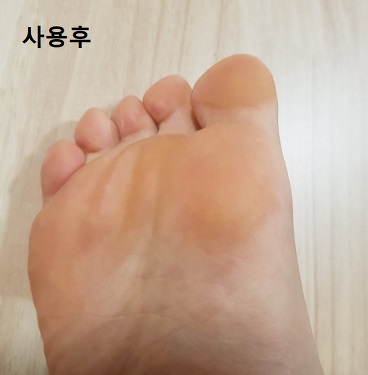 커먼하우스-사용후