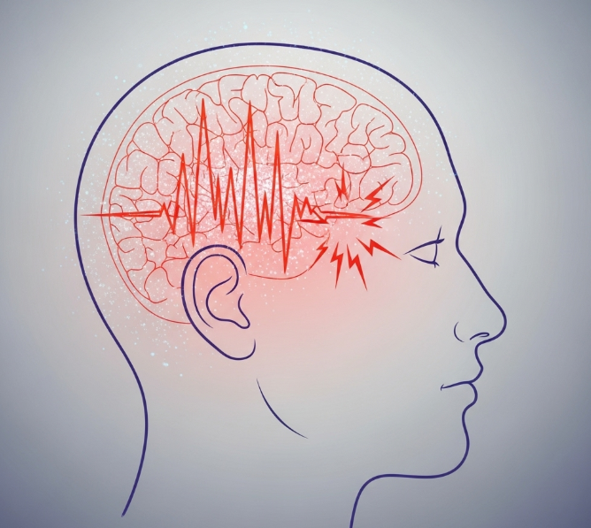 왼쪽 머리 찌릿찌릿한 증상, 두통·편두통 해결법 - 신경통일까?
