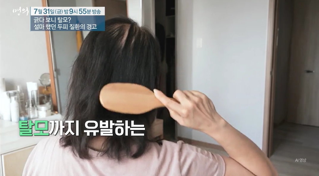 명의 두피질환