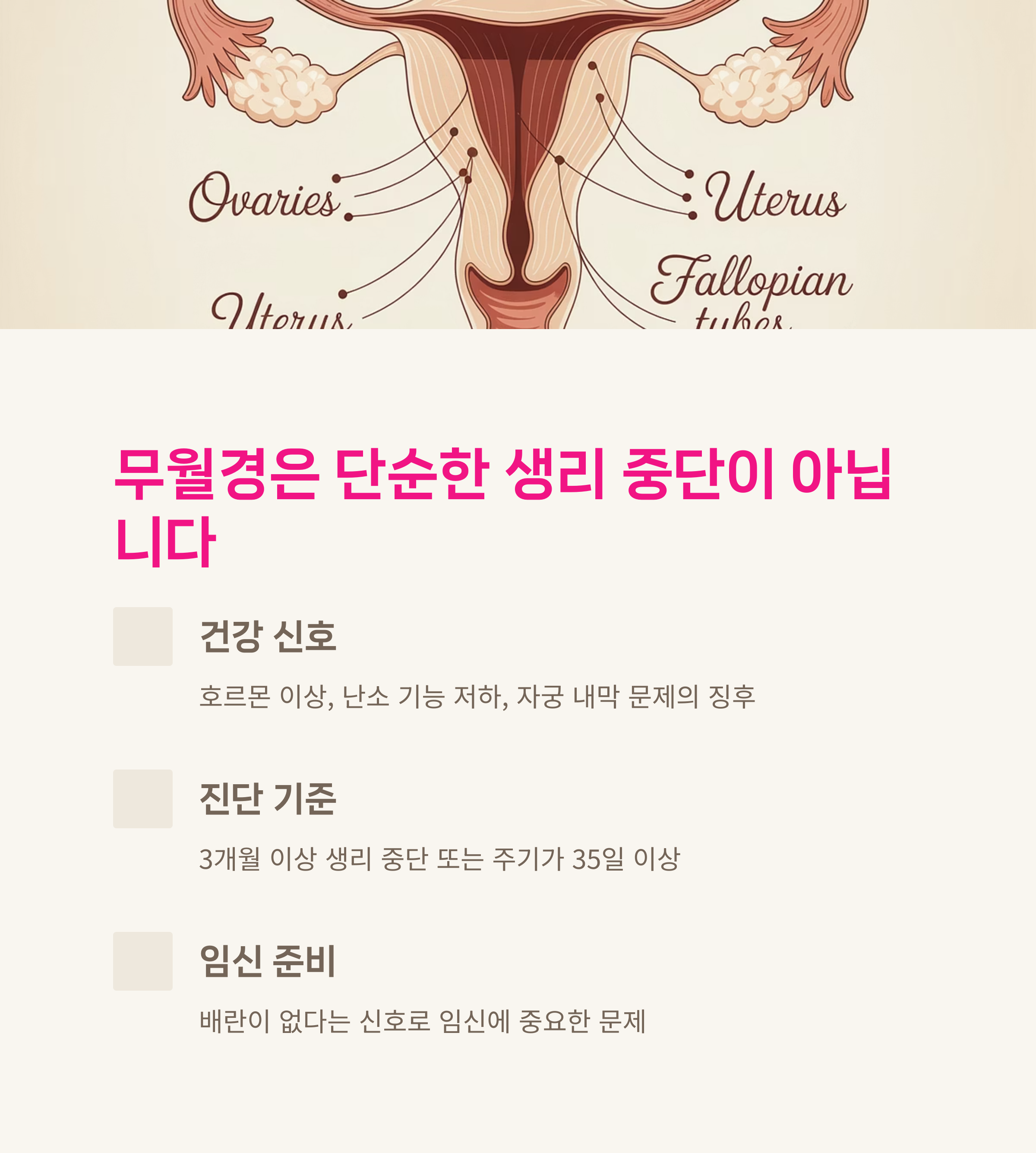 여성 생식기 구조 일러스트와 함께 무월경의 진단 기준, 건강 신호, 임신 준비와의 연관성을 설명한 인포그래픽