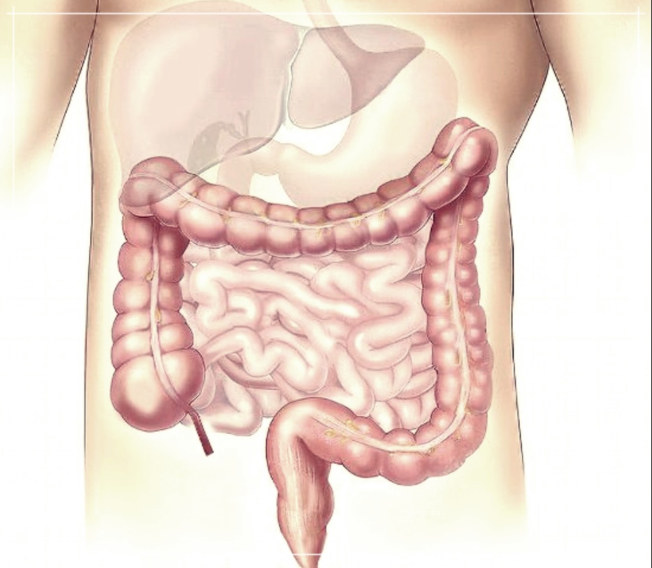 장천공 증상, 치료법 그리고 수술 후 좋은 음식에 대해