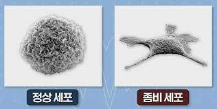 노화 좀비세포