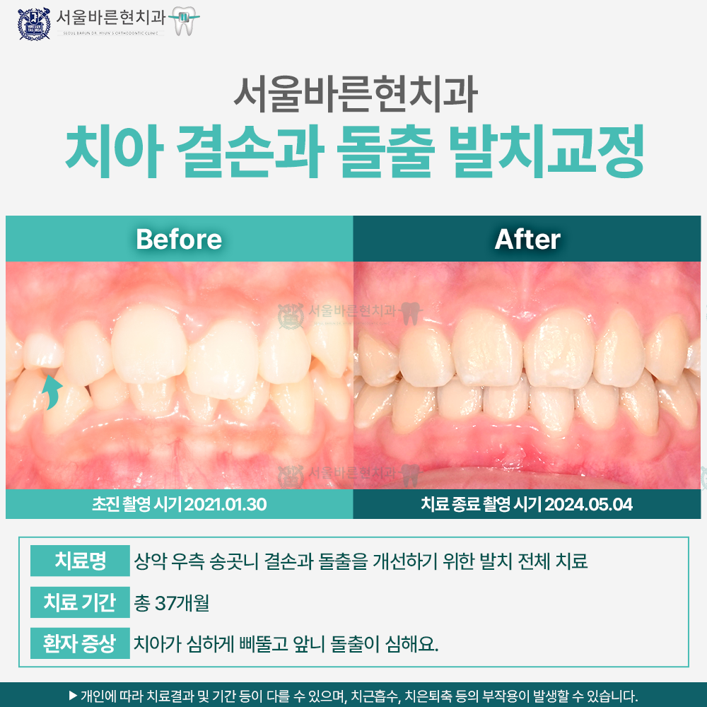 부산교정치과