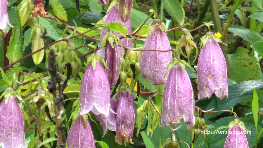 행동으로 나타나는 치매의 초기 증상