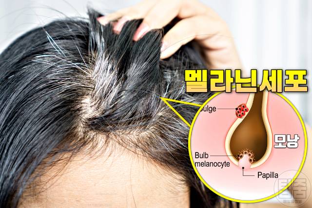 흰머리 없애는 음식 흰머리 검은머리로