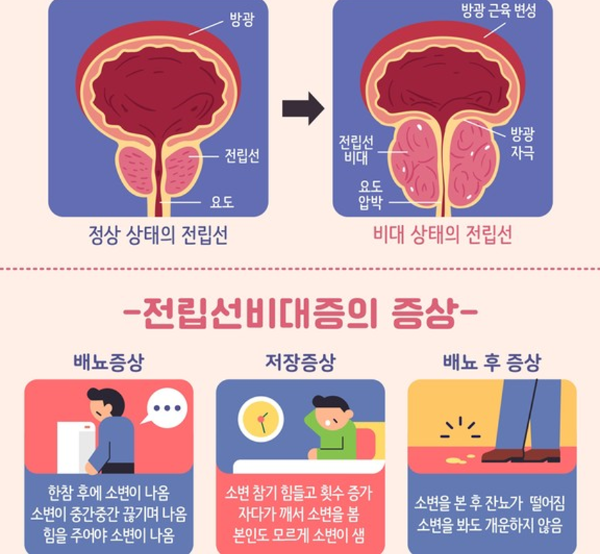 쏘팔메토 베타 시토스테롤 전립선 건강 전립선비대증 야뇨 잔뇨 전립선암 영양제 보충제 건강기능식품