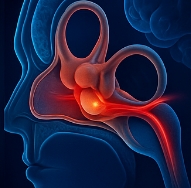 전정신경염 증상