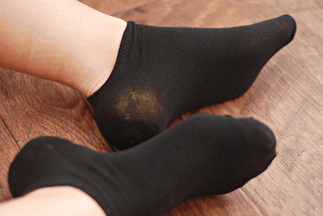 발뒤꿈치 각질제거 갈라짐,뒤꿈치 굳은살 제거,레몬껍질,풋크림