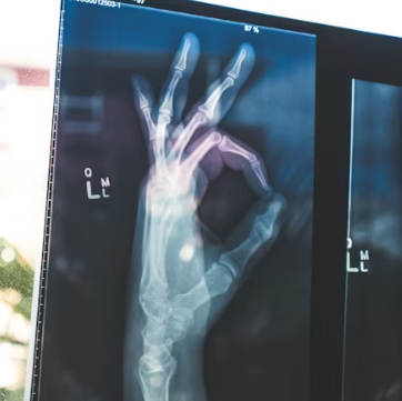 공심채 효능 부작용 고르는법 칼로리 다연채 모닝글로리