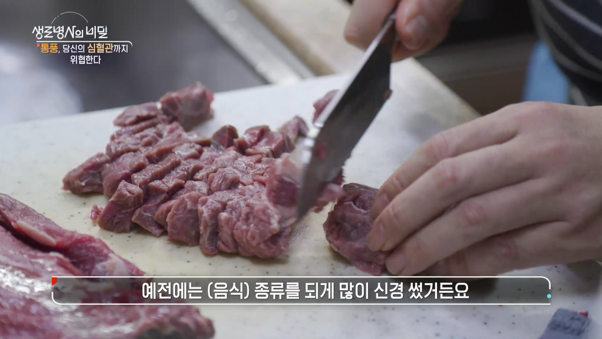 생로병사의 비밀 통풍