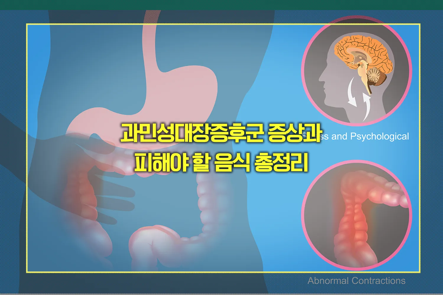 과민성대장증후군 증상 피해야 할 음식