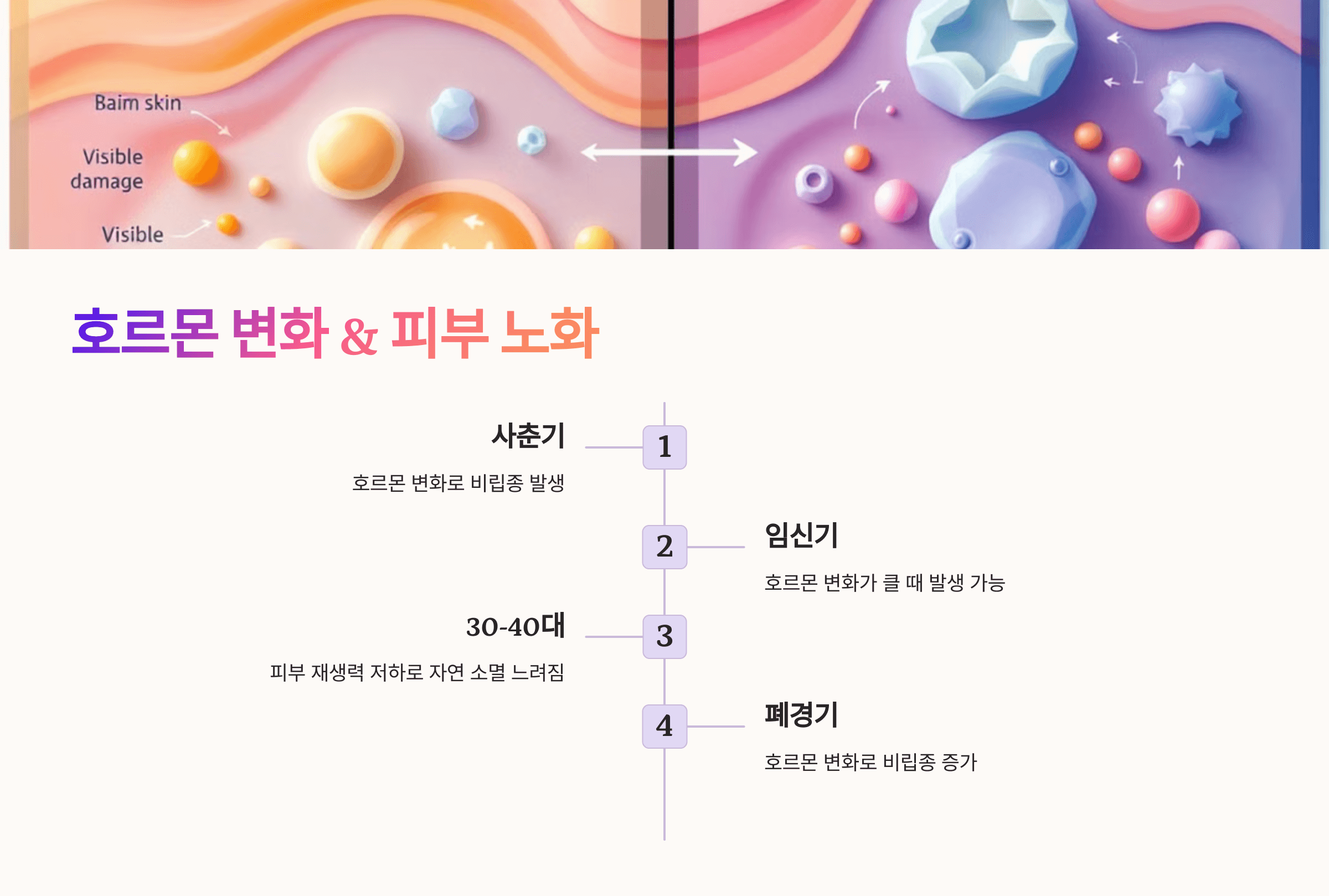 비립종과 관련된 사진입니다.