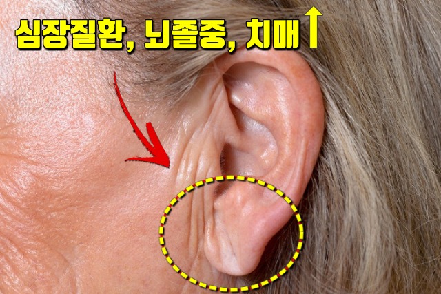 귀 지압점,피로에 좋은 지압법,팁줌