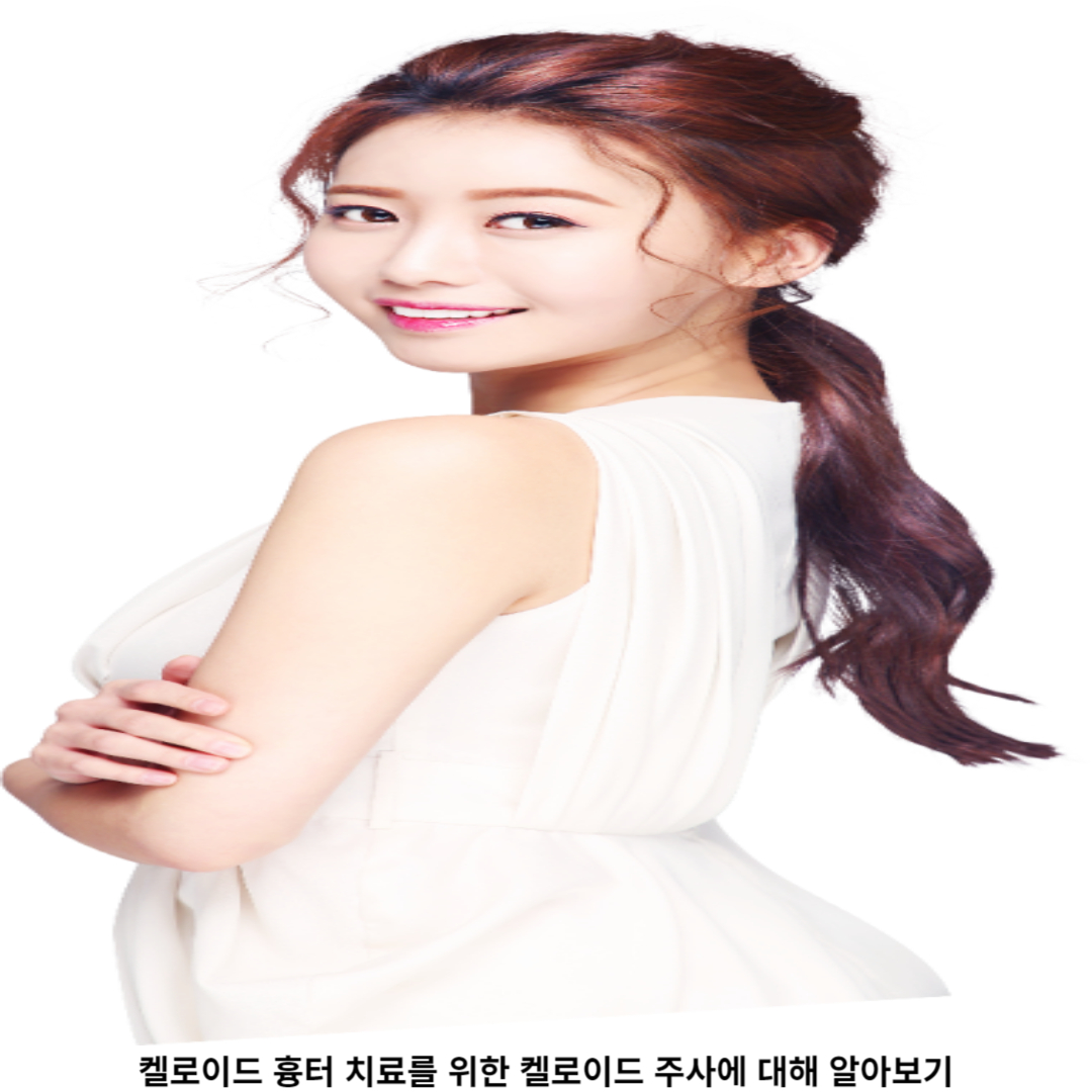 켈로이드 주사 치료 / 예방
