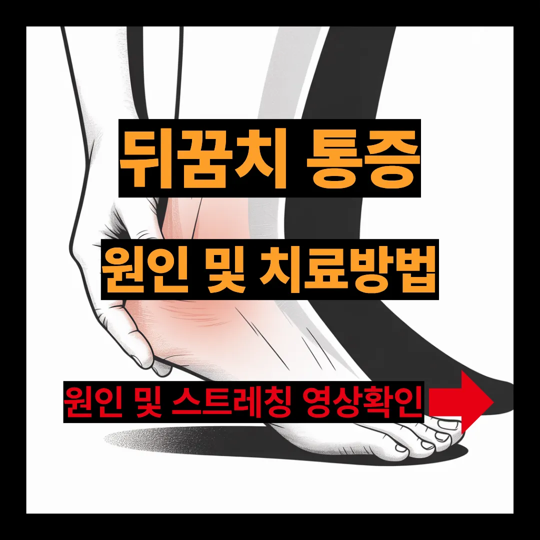뒤꿈치 통증 원인 및 치료방법 스트레칭 영상 보기