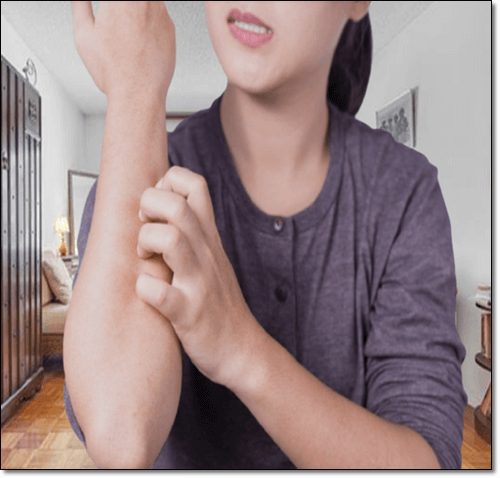 피부 알레르기가 있는 여성