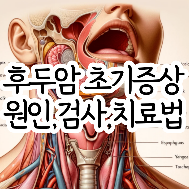 후두암 초기증상 원인 검사 수술