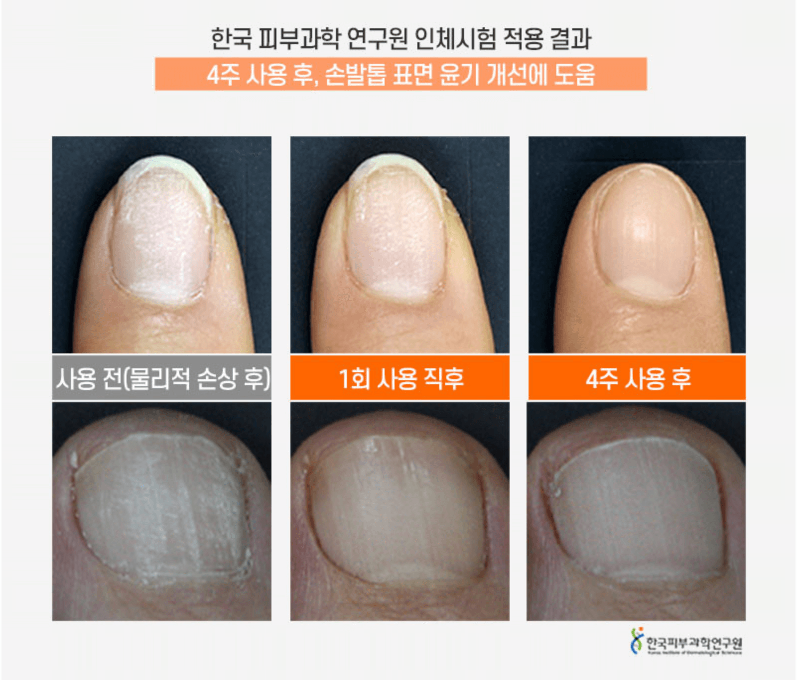 케라셀 효과