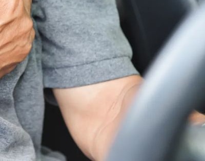 급성 신부전증 증상