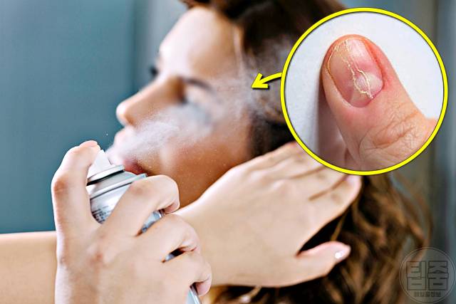 손톱 갈라짐 이유 손톱부러짐