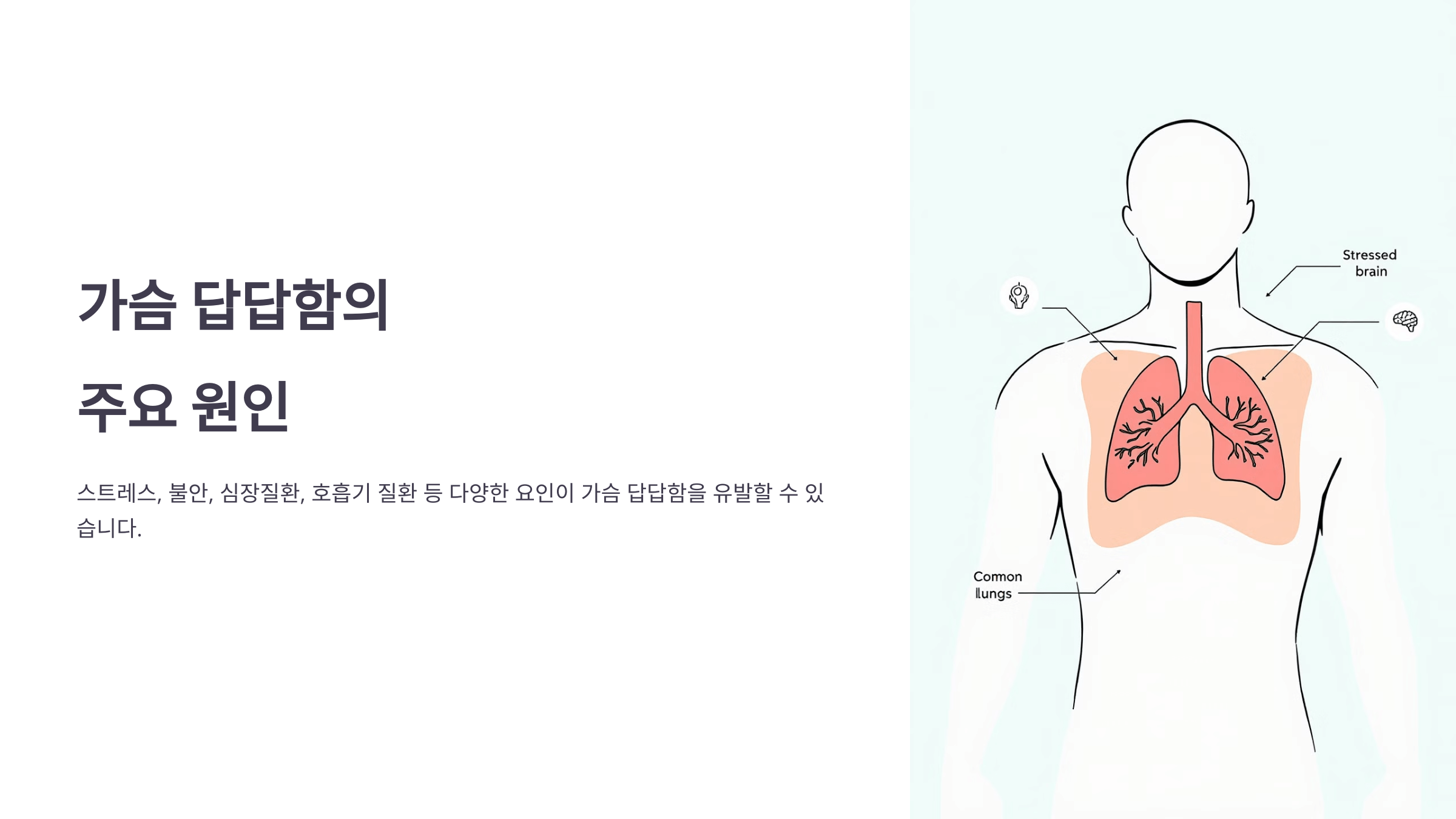 가슴이 답답한 증세