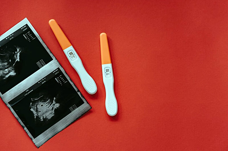 임신-테스트기와-초음파-사진의-모습
