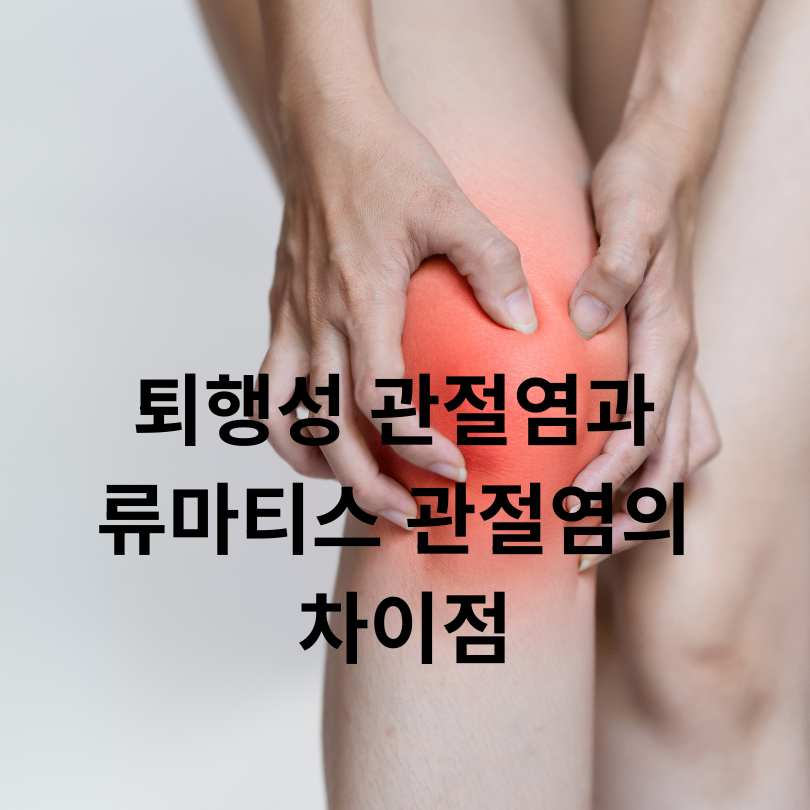 퇴행성 관절염과 류마티스 관절염의 차이점