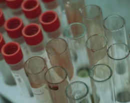 폐경기 생리증상 변화 대처법