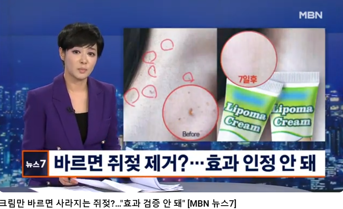 쥐젖 증상과 특징