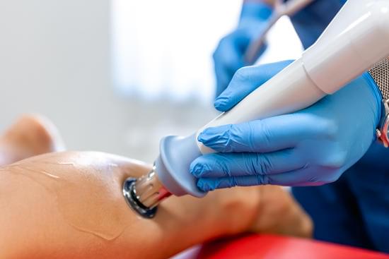 체외충격파 치료 (ESWT, Extracorporeal Shock Wave Therapy)