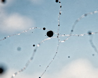 눈에 날파리 현상