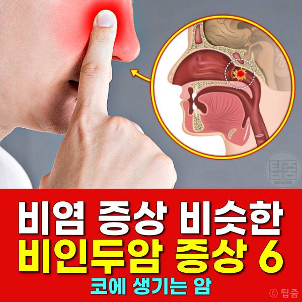 비인두암 증상 비염 증상