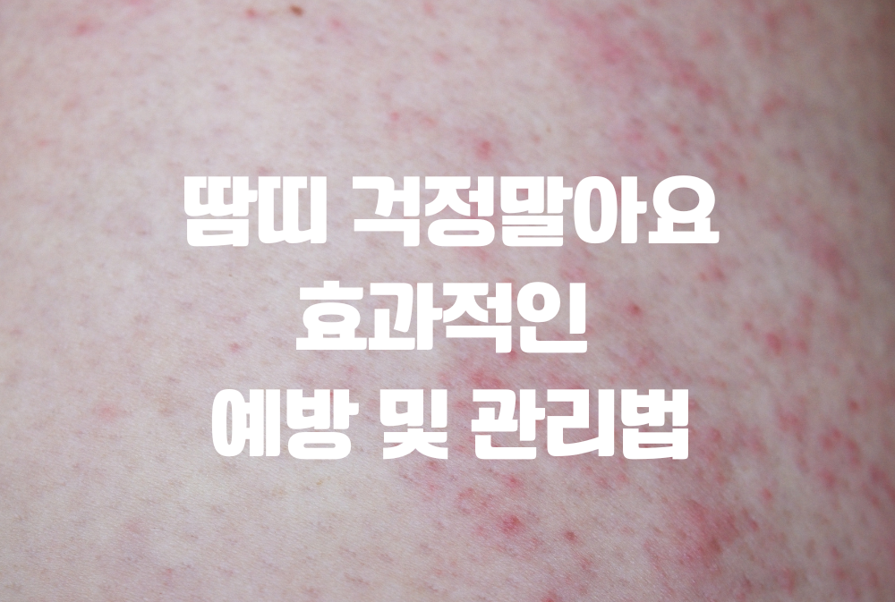 땀띠 걱정말아요 효과적인 예방 및 관리법