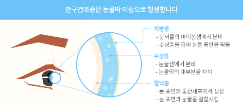 콘드로이친 효능 부작용