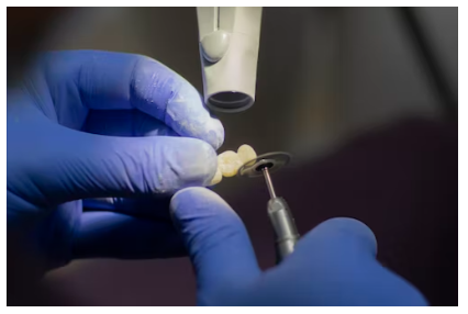 임플란트 장단점