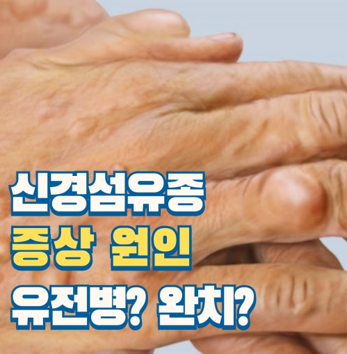 신경섬유종 증상 희귀 유전 질환 치료