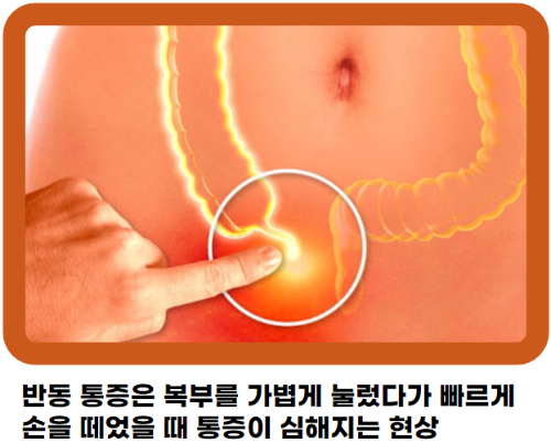 반동 통증의 진단적 가치