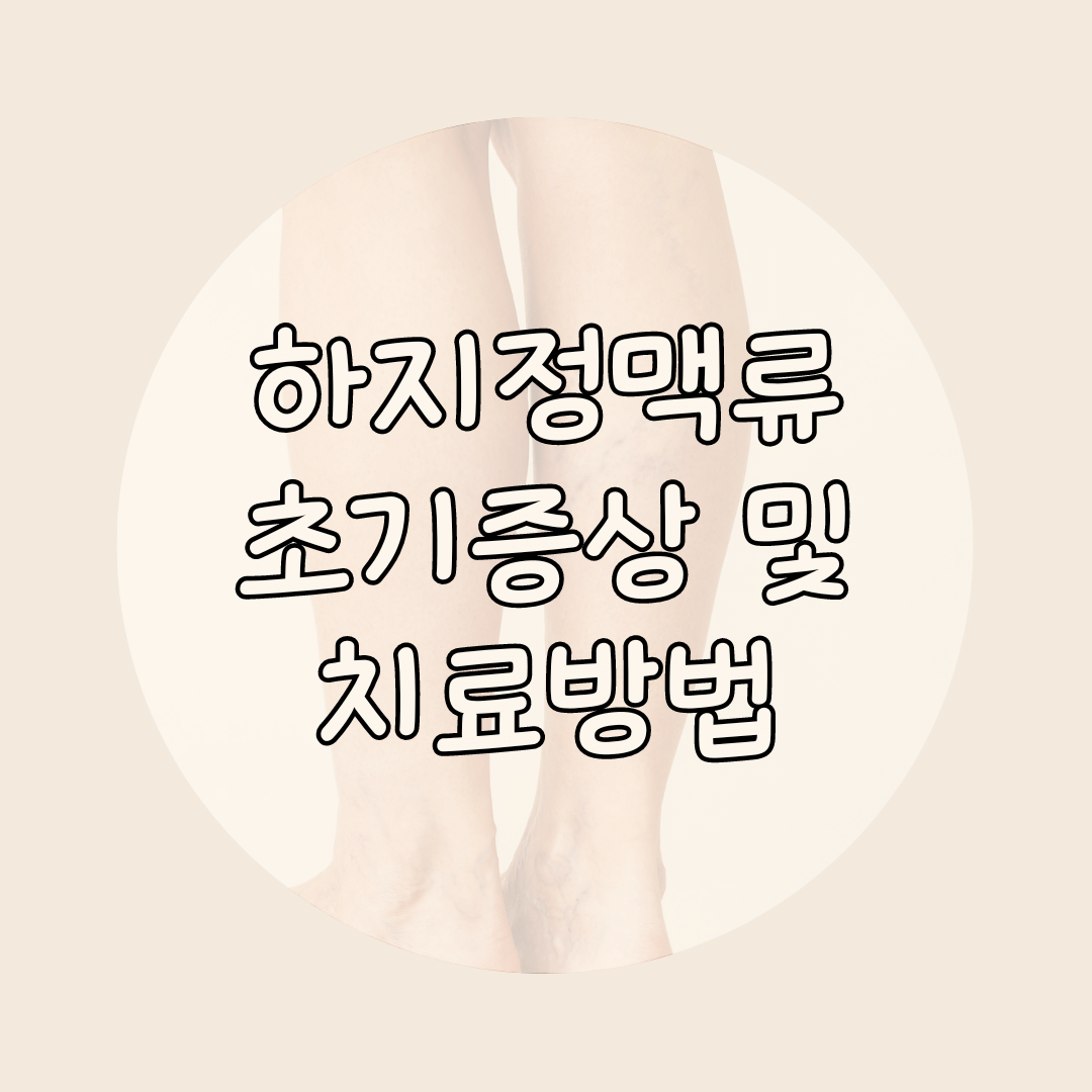 하지정맥류