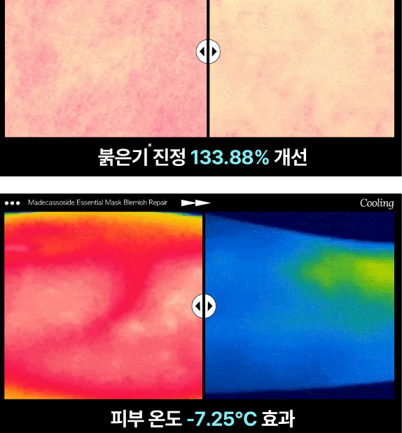 올리브영 best 메디힐 마데카소사이드 에센셜 마스크팩 추천