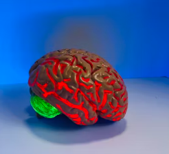 알츠하이머에 좋은 음식 영양제 식단