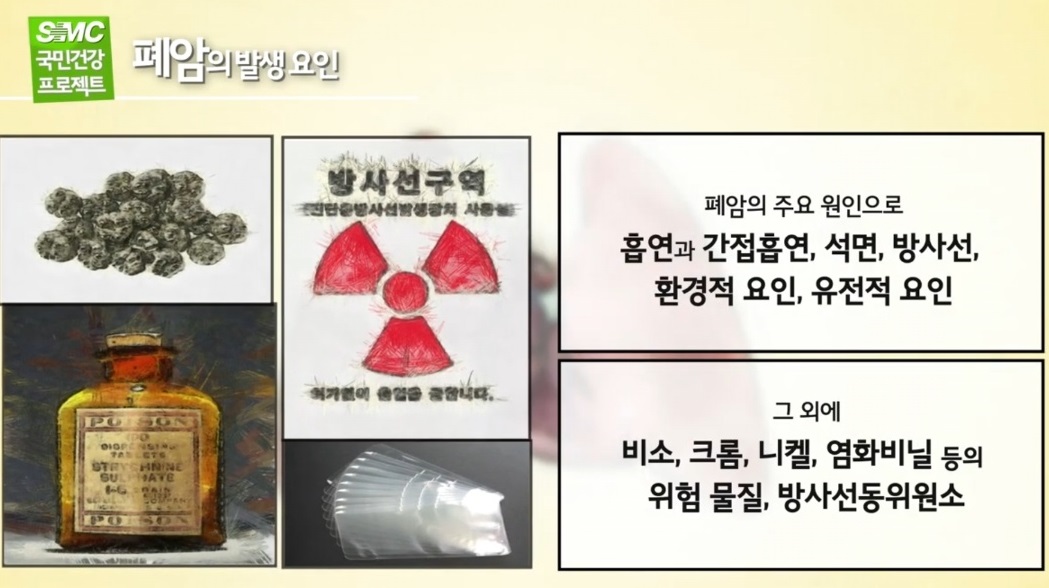 EBS명의-폐명의-임재준-교수