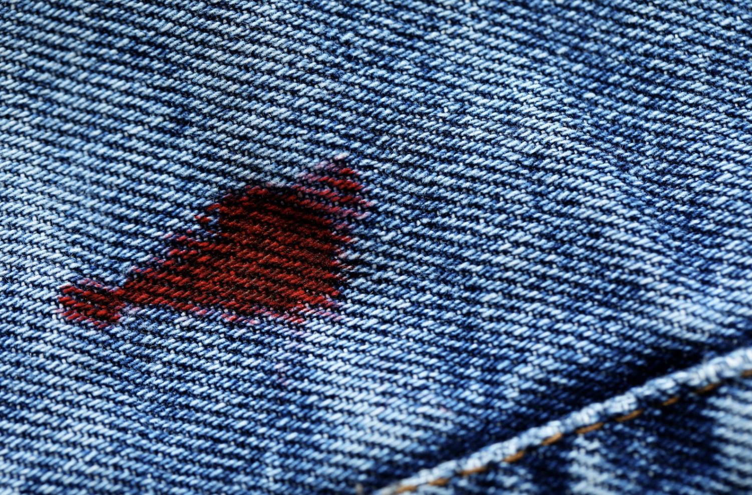 옷에 묻은 립스틱·볼펜·김치국물 얼룩 지우는 법