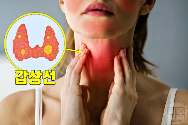 얼굴 붉은기 원인 얼굴 빨개지는 이유 얼굴홍조 원인 갑상선 항진증