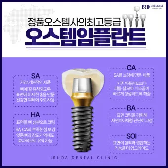 오스템 임플란트 수명 시술기간_7