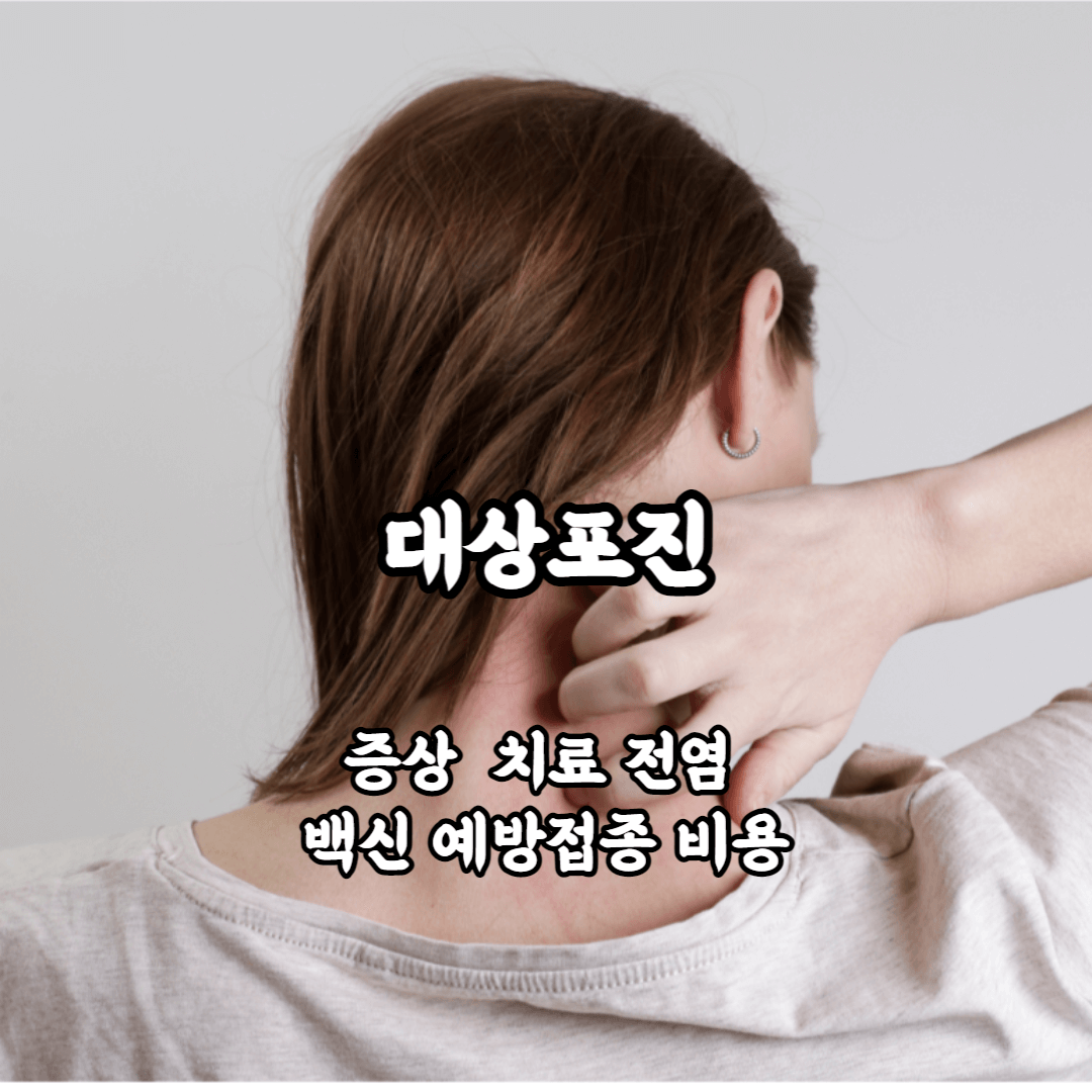 대상포진 초기증상 증상 치료 전염 백신 예방접종 백신 가격