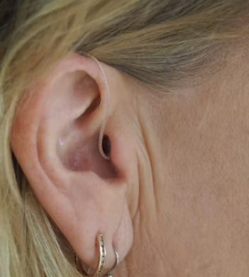 난청 정부 지원금