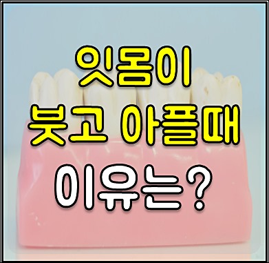 잇몸이 붓는 이유 1