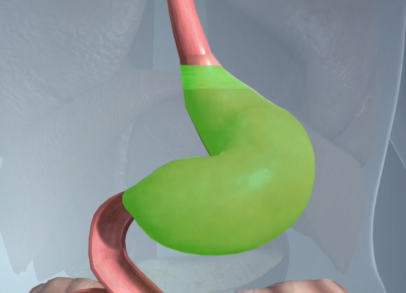 소화불량 위 이미지