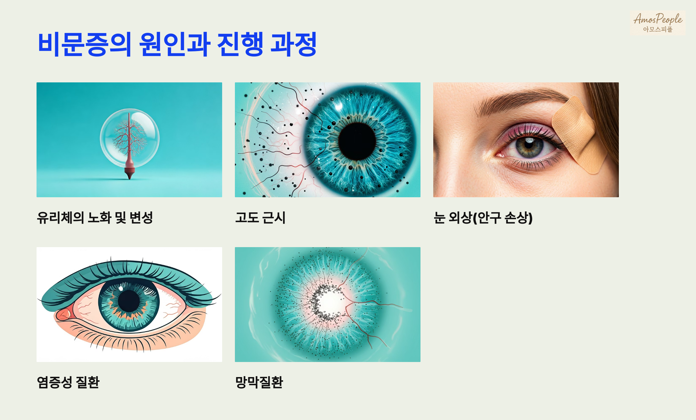 비문증의 원인과 진행 과정