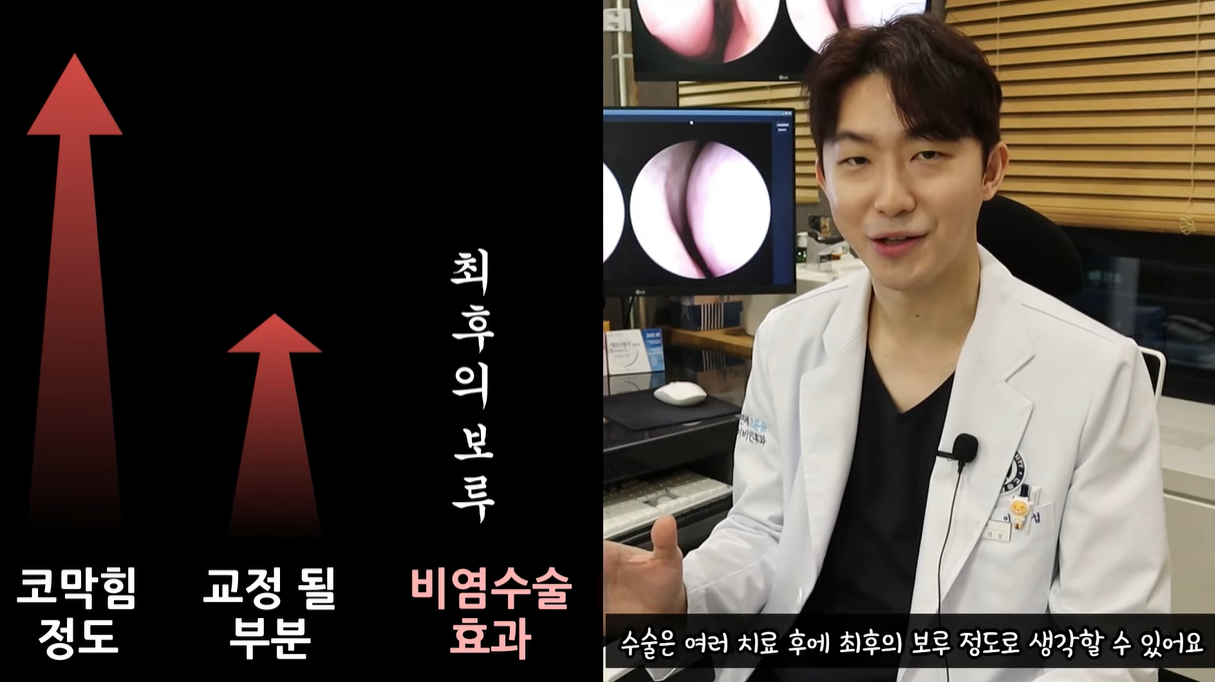 비염수술은 최후의 보루